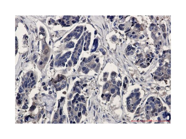 aladdin 阿拉丁 Ab102233 Recombinant ERK2 Antibody Recombinant (R07-1A9); Rabbit anti Human ERK2 Antibody; WB, IHC, IF, ICC; Unconjugated