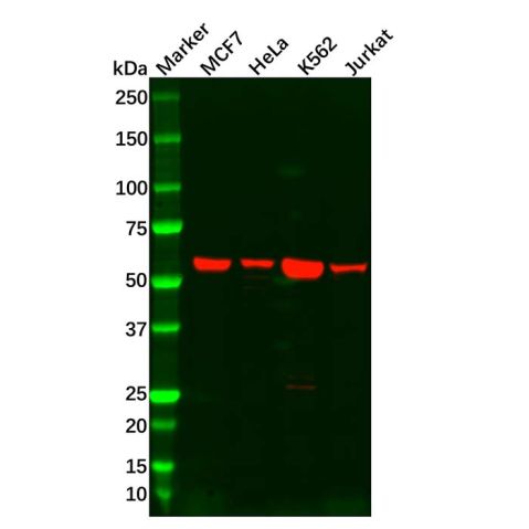 aladdin 阿拉丁 Ab102374 Estrogen Receptor beta Antibody pAb; Rabbit anti Human Estrogen Receptor beta Antibody; WB, IHC; Unconjugated