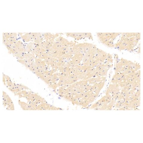 aladdin 阿拉丁 Ab102606 FABP4 Mouse mAb mAb (C12); Mouse anti Human FABP4 Antibody; WB, IHC; Unconjugated