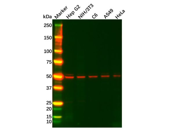 aladdin 阿拉丁 Ab102760 Recombinant FADS1 Antibody Recombinant (R02-1F0); Rabbit anti Human FADS1 Antibody; WB, IHC, ICC, IF; Unconjugated