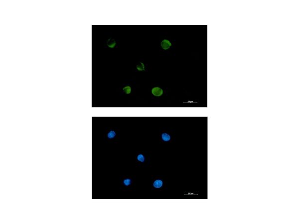 aladdin 阿拉丁 Ab102760 Recombinant FADS1 Antibody Recombinant (R02-1F0); Rabbit anti Human FADS1 Antibody; WB, IHC, ICC, IF; Unconjugated