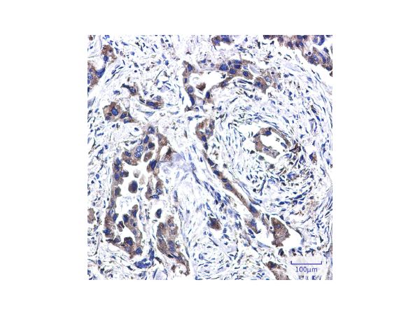 aladdin 阿拉丁 Ab102760 Recombinant FADS1 Antibody Recombinant (R02-1F0); Rabbit anti Human FADS1 Antibody; WB, IHC, ICC, IF; Unconjugated