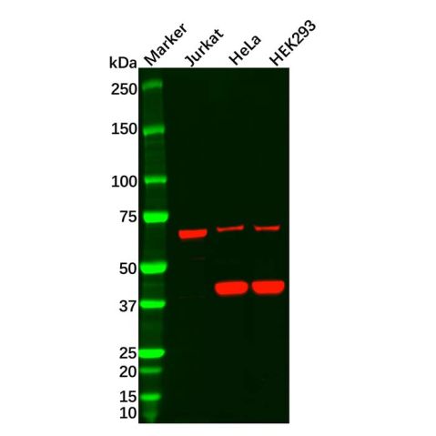 aladdin 阿拉丁 Ab104134 Recombinant Frizzled 8 Antibody Recombinant (R09-1M9); Rabbit anti Human Frizzled 8 Antibody; WB; Unconjugated