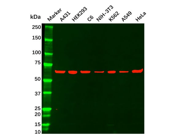 aladdin 阿拉丁 Ab104334 Recombinant G3BP Antibody Recombinant (R06-5D2); Rabbit anti Human G3BP Antibody; WB, ICC, IF, IHC; Unconjugated