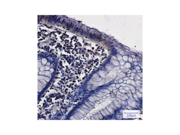 aladdin 阿拉丁 Ab104334 Recombinant G3BP Antibody Recombinant (R06-5D2); Rabbit anti Human G3BP Antibody; WB, ICC, IF, IHC; Unconjugated