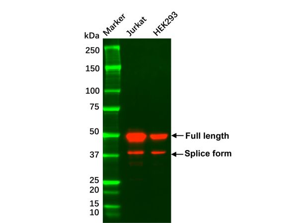 aladdin 阿拉丁 Ab104881 Recombinant GATA3 Antibody Recombinant (R03-7H8); Rabbit anti Human GATA3 Antibody; WB, IHC; Unconjugated