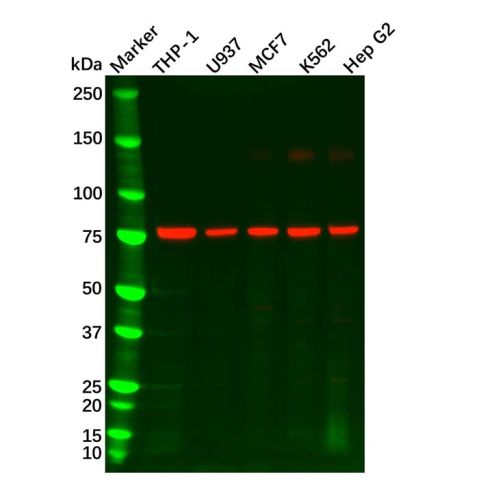 aladdin 阿拉丁 Ab105080 GCSF Receptor Antibody pAb; Rabbit anti Human GCSF Receptor Antibody; WB, IHC, ICC/IF ; Unconjugated