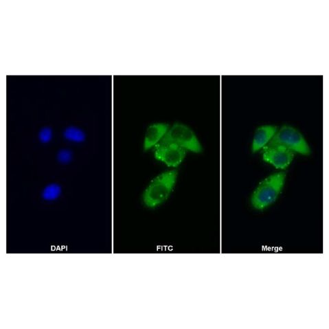 aladdin 阿拉丁 Ab105080 GCSF Receptor Antibody pAb; Rabbit anti Human GCSF Receptor Antibody; WB, IHC, ICC/IF ; Unconjugated