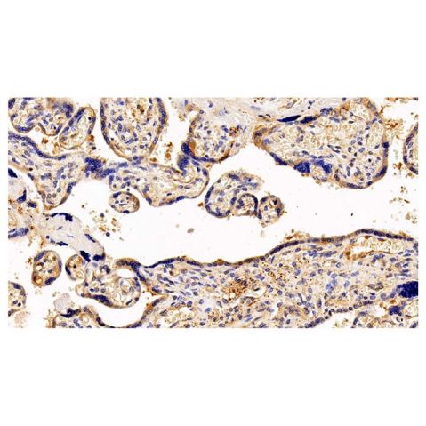 aladdin 阿拉丁 Ab105080 GCSF Receptor Antibody pAb; Rabbit anti Human GCSF Receptor Antibody; WB, IHC, ICC/IF ; Unconjugated