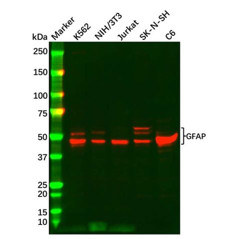 aladdin 阿拉丁 Ab105229 GFAP Antibody pAb; Rabbit anti Human GFAP Antibody; WB, IHC; Unconjugated