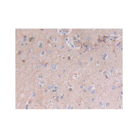 aladdin 阿拉丁 Ab105229 GFAP Antibody pAb; Rabbit anti Human GFAP Antibody; WB, IHC; Unconjugated