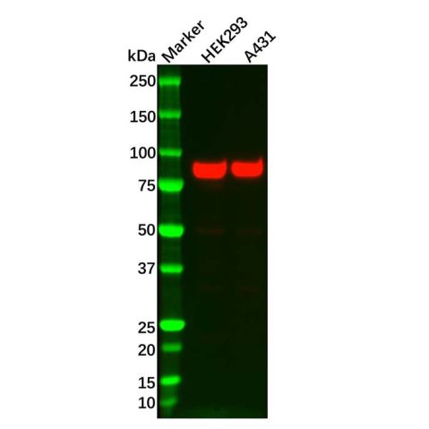 aladdin 阿拉丁 Ab105776 Recombinant Glycogen synthase 1/GYS1 Antibody Recombinant (R02-2F3); Rabbit anti Human Glycogen synthase 1/GYS1  Antibody; WB, IF, ICC; Unconjugated