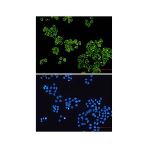 aladdin 阿拉丁 Ab105776 Recombinant Glycogen synthase 1/GYS1 Antibody Recombinant (R02-2F3); Rabbit anti Human Glycogen synthase 1/GYS1  Antibody; WB, IF, ICC; Unconjugated