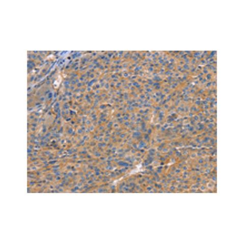 aladdin 阿拉丁 Ab105938 GNB1 Antibody pAb; Rabbit anti Human GNB1 Antibody; WB, IHC; Unconjugated