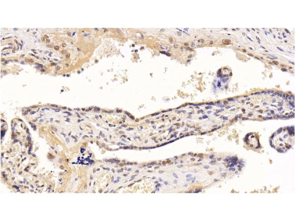 aladdin 阿拉丁 Ab107009 HDAC1 Mouse mAb mAb (E22); Mouse anti Human HDAC1 Antibody; WB, IHC, IF, ICC; Unconjugated