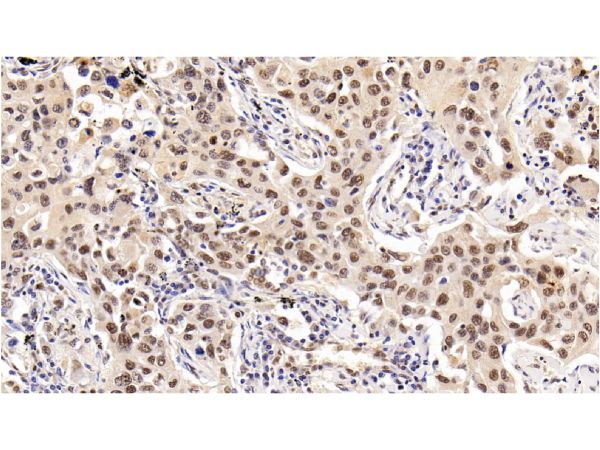 aladdin 阿拉丁 Ab107009 HDAC1 Mouse mAb mAb (E22); Mouse anti Human HDAC1 Antibody; WB, IHC, IF, ICC; Unconjugated