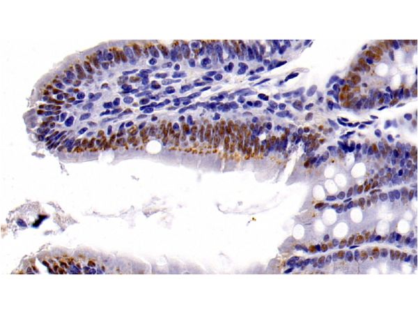 aladdin 阿拉丁 Ab107009 HDAC1 Mouse mAb mAb (E22); Mouse anti Human HDAC1 Antibody; WB, IHC, IF, ICC; Unconjugated