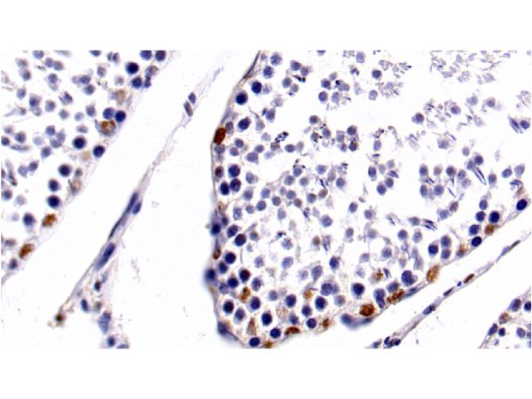 aladdin 阿拉丁 Ab107009 HDAC1 Mouse mAb mAb (E22); Mouse anti Human HDAC1 Antibody; WB, IHC, IF, ICC; Unconjugated