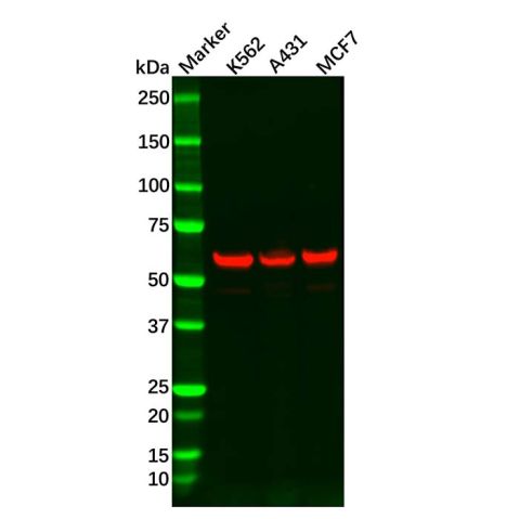 aladdin 阿拉丁 Ab107031 Recombinant HDAC2 Antibody Recombinant (R06-4E4); Rabbit anti Human HDAC2 Antibody; WB, IHC, IF, ICC; Unconjugated