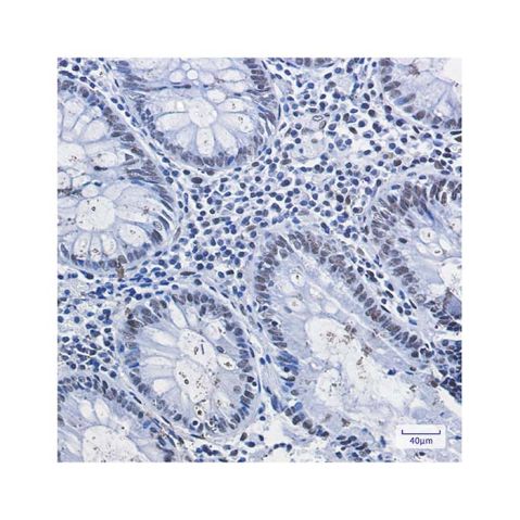 aladdin 阿拉丁 Ab107031 Recombinant HDAC2 Antibody Recombinant (R06-4E4); Rabbit anti Human HDAC2 Antibody; WB, IHC, IF, ICC; Unconjugated