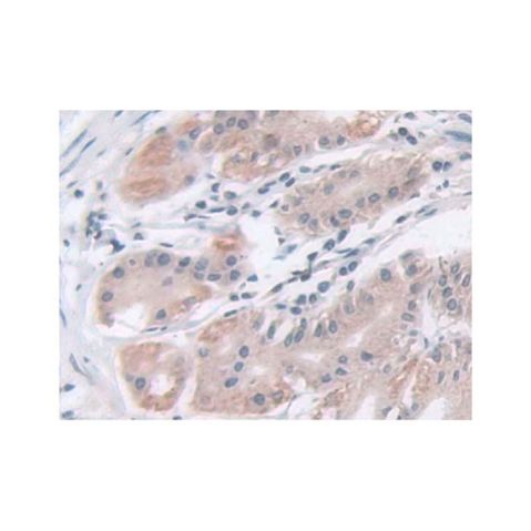 aladdin 阿拉丁 Ab109347 IDH2 Antibody pAb; Rabbit anti Human IDH2 Antibody; WB, IHC; Unconjugated