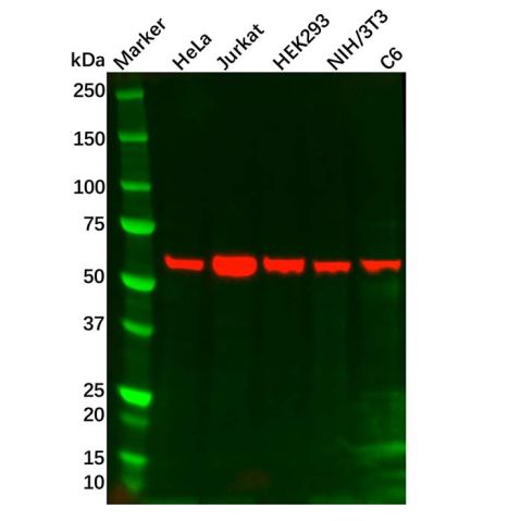 aladdin 阿拉丁 Ab109838 IL10RB  Mouse mAb mAb (C1); Mouse anti Human IL10RB Antibody; WB; Unconjugated