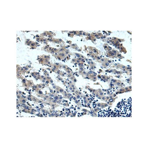 aladdin 阿拉丁 Ab109915 IL-13 receptor alpha 1 Antibody pAb; Rabbit anti Human IL-13 receptor alpha 1 Antibody; WB, IHC; Unconjugated