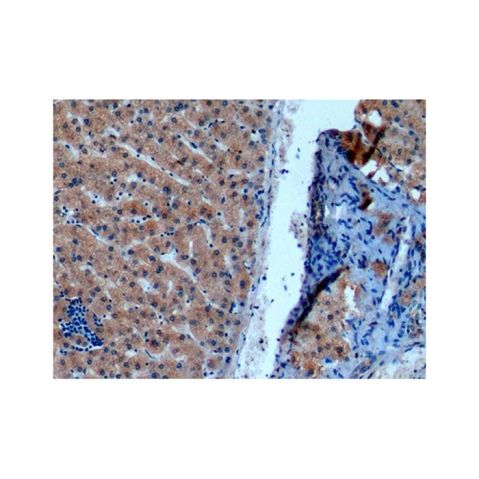 aladdin 阿拉丁 Ab110648 iNOS Mouse mAb mAb (C1); Mouse anti Human iNOS Antibody; WB, IHC; Unconjugated