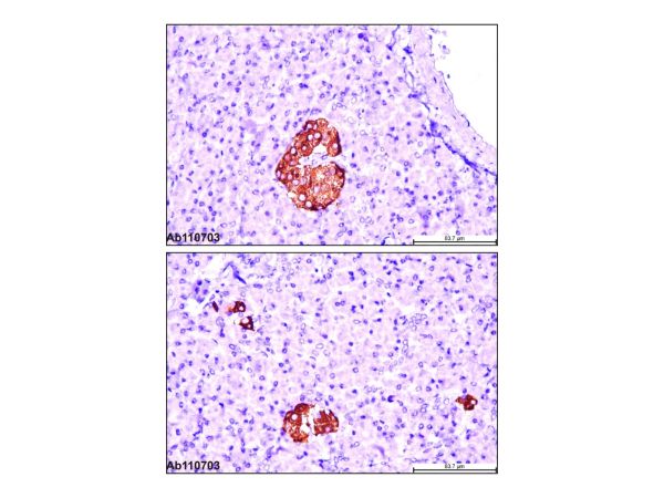 aladdin 阿拉丁 Ab110703 Recombinant Insulin Antibody Recombinant (EPR17359),  Rabbit anti Human Insulin Antibody; IHC, WB, ICC, IF; Unconjugated