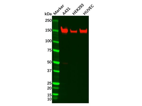 aladdin 阿拉丁 Ab110755 Recombinant Integrin alpha 2 Antibody Recombinant (R09-7C3); Rabbit anti Human Integrin alpha 2 Antibody; WB, IHC; Unconjugated