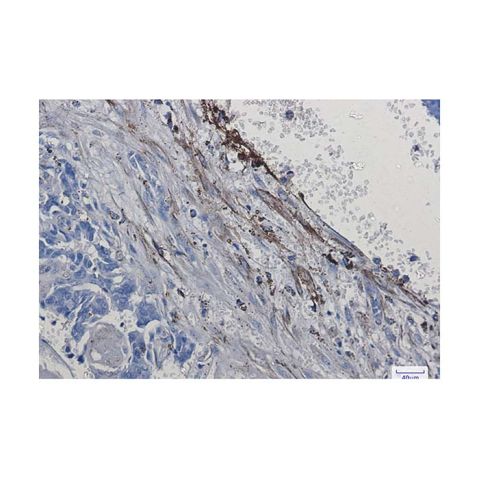 aladdin 阿拉丁 Ab110802 Recombinant Integrin alpha 5 Antibody Recombinant (R02-3G4); Rabbit anti Human Integrin alpha 5 Antibody; WB, IHC; Unconjugated