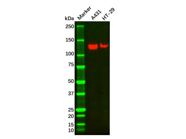 aladdin 阿拉丁 Ab110811 Recombinant Integrin alpha 6 Antibody Recombinant (R01-6B2); Rabbit anti Human Integrin alpha 6 Antibody; WB, IHC; 