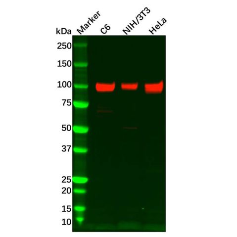 aladdin 阿拉丁 Ab110875 Recombinant Integrin beta 3 Antibody Recombinant (R02-5I9); Rabbit anti Human Integrin beta 3 Antibody; WB; Unconjugated