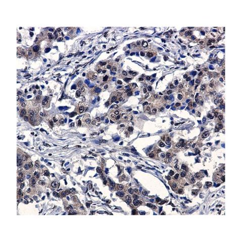 aladdin 阿拉丁 Ab111215 Recombinant IRF3 Antibody Recombinant (R02-6B0); Rabbit anti Human IRF3 Antibody; WB, IHC; Unconjugated