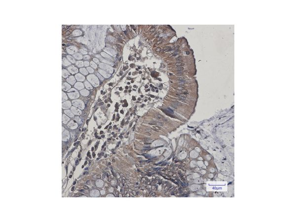 aladdin 阿拉丁 Ab111533 Recombinant JNK2 Antibody Recombinant (R02-9H4); Rabbit anti Human JNK2 Antibody; WB, IHC; Unconjugated