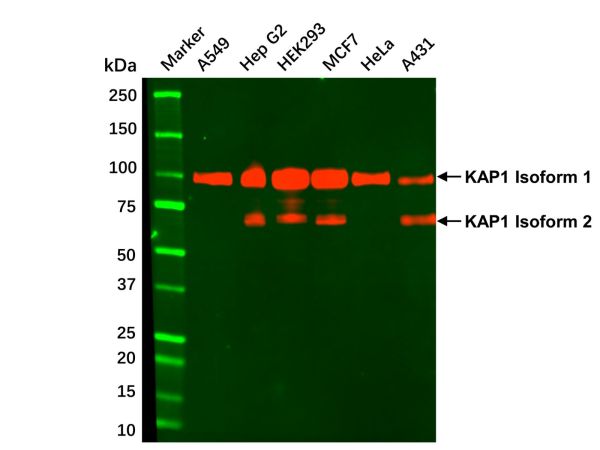 aladdin 阿拉丁 Ab111687 KAP1 Mouse mAb mAb(4E1-D12-F8); Mouse anti Human KAP1 Antibody; WB, IHC-F, IHC-P, ICC/IF, IP; Unconjugated