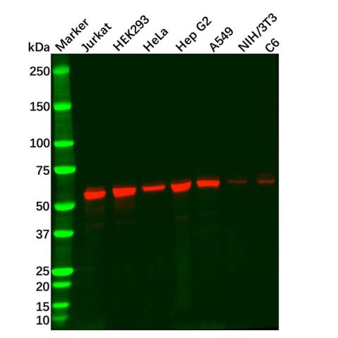 aladdin 阿拉丁 Ab112361 KPNA2 Mouse mAb mAb(C8); Mouse anti Human KPNA2 Antibody; WB, IHC; Unconjugated