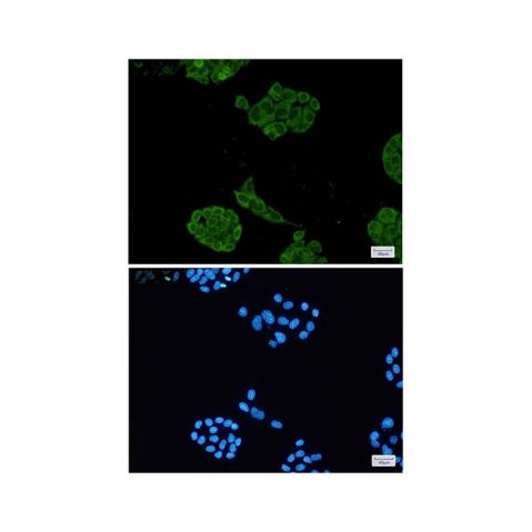 aladdin 阿拉丁 Ab112519 Recombinant Lactate Dehydrogenase Antibody Recombinant (R06-6J2); Rabbit anti Human Lactate Dehydrogenase Antibody; WB, IHC, ICC, IF; Unconjugated