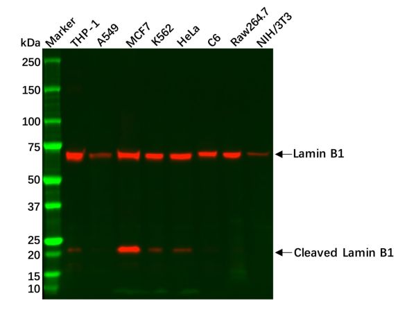 aladdin 阿拉丁 Ab112659 Recombinant Lamin B1 Antibody Recombinant (R05-8D6); Rabbit anti Human Lamin B1 Antibody; WB, IHC; Unconjugated