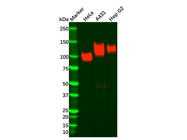 aladdin 阿拉丁 Ab112727 Recombinant LAMP1 Antibody Recombinant (R05-7D4); Rabbit anti Human LAMP1 Antibody; WB, IHC; Unconjugated