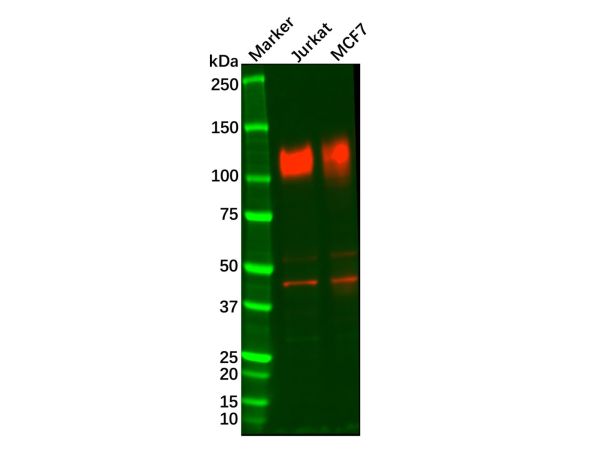 aladdin 阿拉丁 Ab112727 Recombinant LAMP1 Antibody Recombinant (R05-7D4); Rabbit anti Human LAMP1 Antibody; WB, IHC; Unconjugated