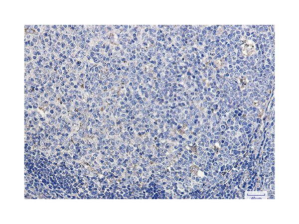 aladdin 阿拉丁 Ab112727 Recombinant LAMP1 Antibody Recombinant (R05-7D4); Rabbit anti Human LAMP1 Antibody; WB, IHC; Unconjugated