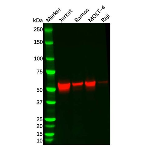 aladdin 阿拉丁 Ab112898 Recombinant Lck Antibody Recombinant (R07-5M3); Rabbit anti Human Lck Antibody; WB; Unconjugated