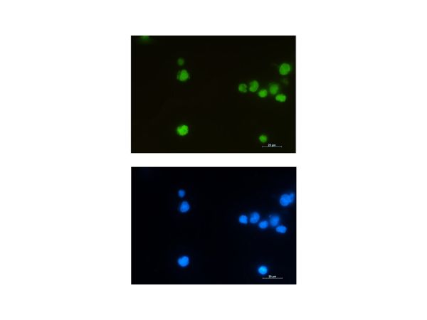 aladdin 阿拉丁 Ab112963 Recombinant LEF1 Antibody Recombinant (R02-3A4); Rabbit anti Human LEF1 Antibody; WB, ICC, IF; Unconjugated 