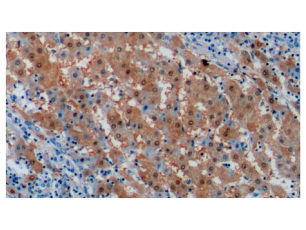 aladdin 阿拉丁 Ab113273 Liver Arginase Mouse mAb mAb (C8); Mouse anti Human Liver Arginase Antibody; WB, IHC; Unconjugated 