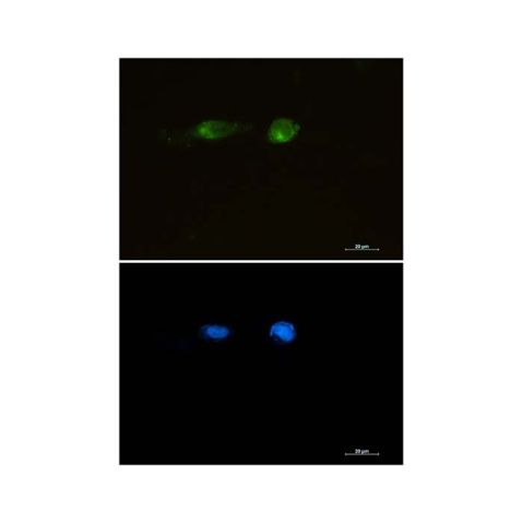 aladdin 阿拉丁 Ab113511 Recombinant LRP1 Antibody Recombinant (R09-4E8); Rabbit anti Human LRP1 Antibody; WB, IHC, ICC, IF; Unconjugated