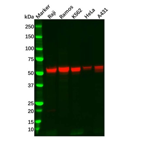 aladdin 阿拉丁 Ab113790 Lyn Mouse mAb mAb (1C8-H3-G6); Mouse anti Human Lyn Antibody; WB; Unconjugated