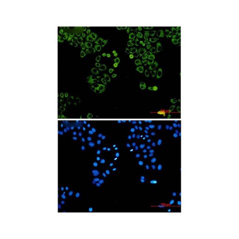 aladdin 阿拉丁 Ab113812 Recombinant LYRIC/AEG1 Antibody Recombinant (R05-5G3); Rabbit anti Human LYRIC/AEG1 Antibody; WB, IHC, ICC, IF; Unconjugated