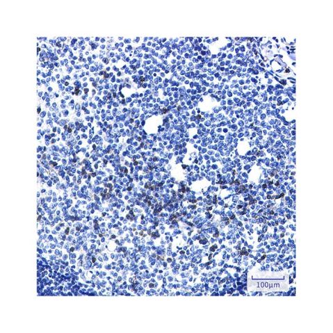 aladdin 阿拉丁 Ab113812 Recombinant LYRIC/AEG1 Antibody Recombinant (R05-5G3); Rabbit anti Human LYRIC/AEG1 Antibody; WB, IHC, ICC, IF; Unconjugated