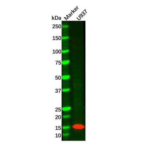 aladdin 阿拉丁 Ab113835 Recombinant Lysozyme Antibody Recombinant (R09-9D6); Rabbit anti Human Lysozyme Antibody; WB, ICC, IF; Unconjugated